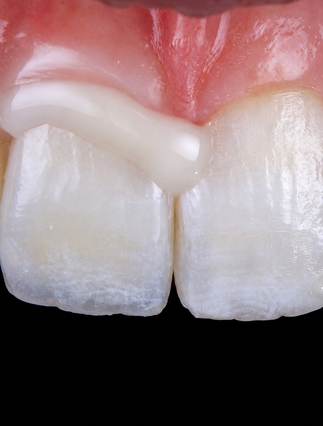 Cementos Dentales FGM